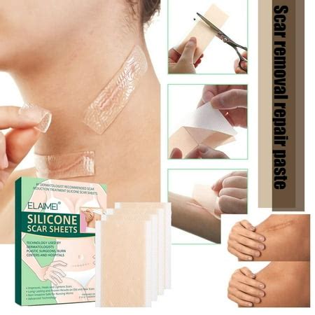 Marks Cesarean Scar Gel Away Silicone Scar Removal Sheet Patch Health ...