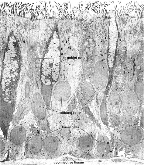 Trachea Histology Goblet Cells