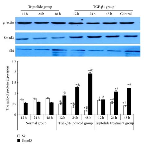 The Effect Of Triptolide On The Tgf Induced Rmc Proliferation