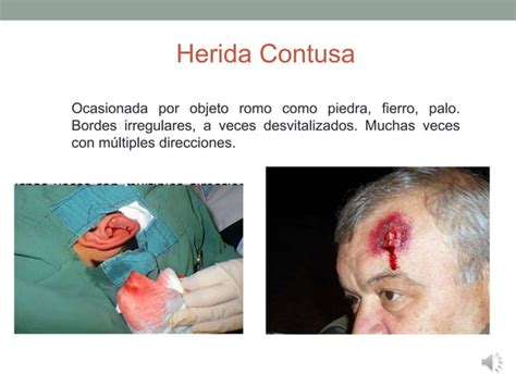 Heridas Y Lavado De Manos Pptx Descarga Gratuita