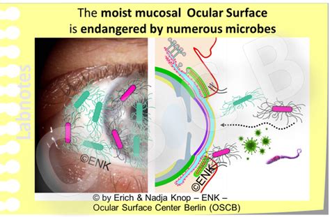 Overview Of The Ocular Surface — Ocular Surface Center Berlin