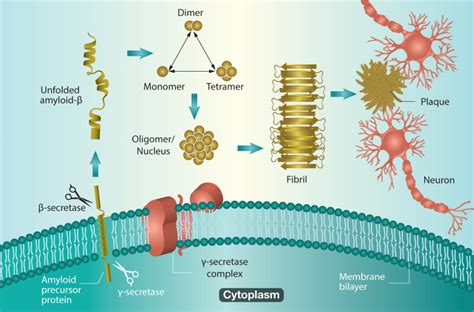 Figure 1 Amyloid β fibrillation and neuronal damage Alzheimer