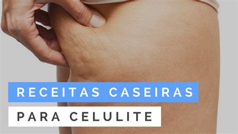 Receita Caseira Como Acabar A Celulite Creme Anticelulite Caseiro