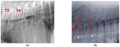 The Agreement Between Radiography And Fluoroscopy As Diagnostic Tools