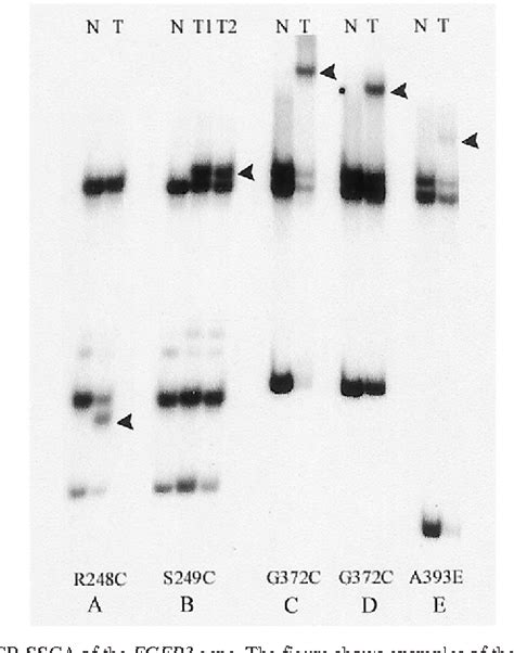 Figure 1 From The Fibroblast Growth Factor Receptor 3 Fgfr3 Mutation