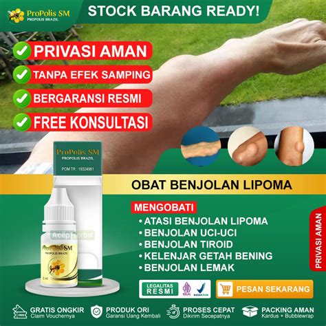 Jual Obat Benjolan Lipoma Bantu Mengatasi Benjolan Uci Uci Benjolan