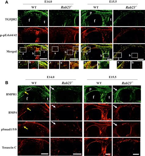 Frontiers RAB23 Regulates Musculoskeletal Development And Patterning