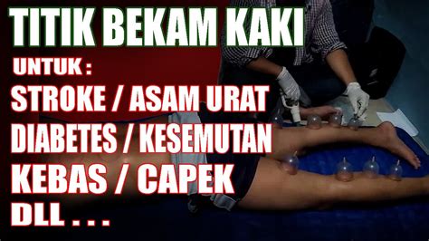 Tutorial Bekam Lengkap Titik Bekam Kaki Pegal Asam Urat Dan Diabetes