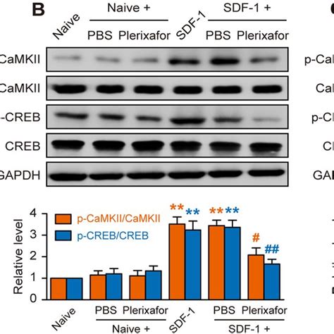 Plc Mediates Camkii Activation A Tpc Cells Were Treated With Mm