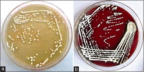 blood   nutrient     plates advancells group