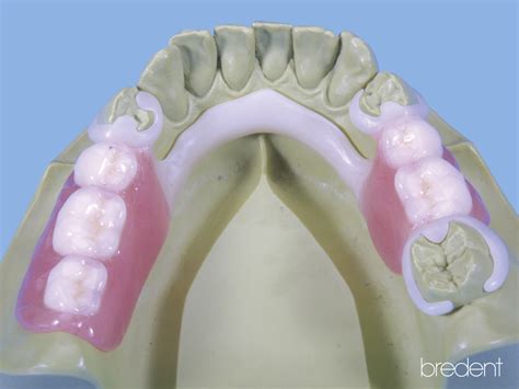 LABORDENT | Bio Dentaplast
