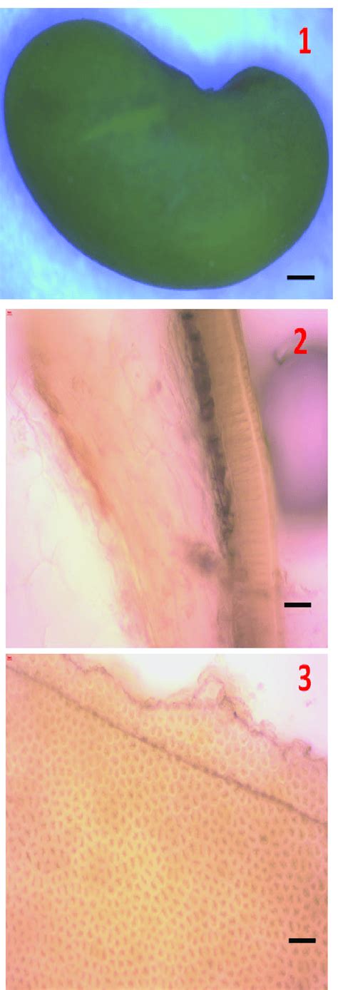 The Seeds Of The Hungarian Variety Hunor Of Alfalfa Seed Under Download Scientific Diagram