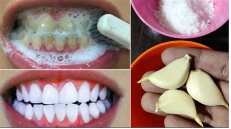 Whiten Yellowbrown Teeth In Two Minutes Youtube