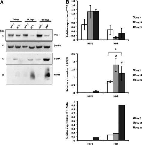 Characterization Of Fibroblasts A Western Blot And B Quantitative