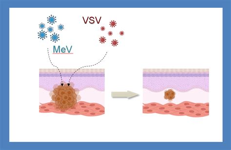 Innovative Solutions For Oncolytic Virotherapy Of Breast Cancer Cirtt