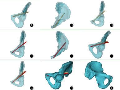 Orthopaedic Surgery X Mol