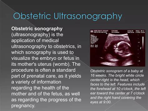 Ultrasonography Ppt