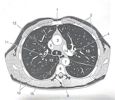 Chest Image 4 Diagram | Quizlet