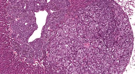 Figures Pathology Of The Mouse Adrenal Gland Toxicologic Pathology