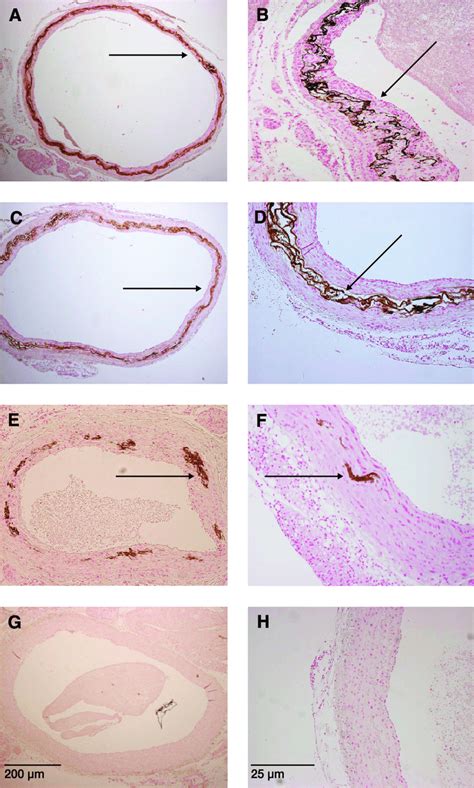 Von Kossa Stains Of The Thoracic Aorta Of Adeninefed Rats After 4 Weeks Download Scientific