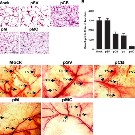 RNAi Mediated Targeting Of Cathepsin B And MMP 9 Inhibits Angiogenesis