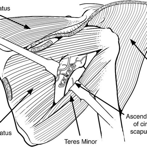 Infraspinatus And Teres Minor Interval Dissection And Fracture Exposure Download Scientific