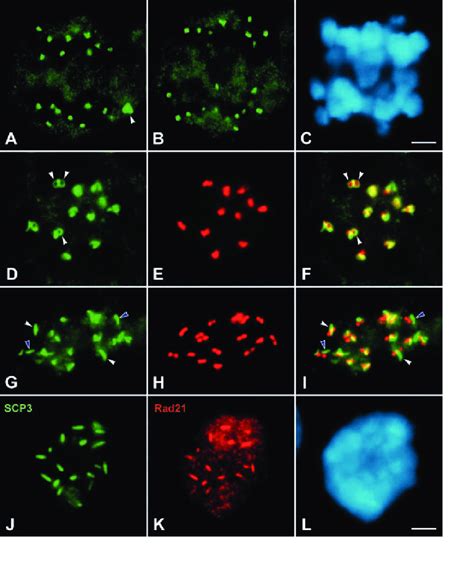 Scp3 And Rad21 Are Lost From Chromosome Arms During The Metaphase