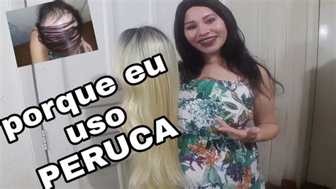 L Quen Plano Pilar Alopecia Cicatricial Queda De Cabelo Minha