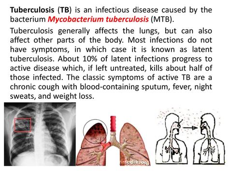 Microbiological Characteristics Of The Causative Agent Of Tuberculosis