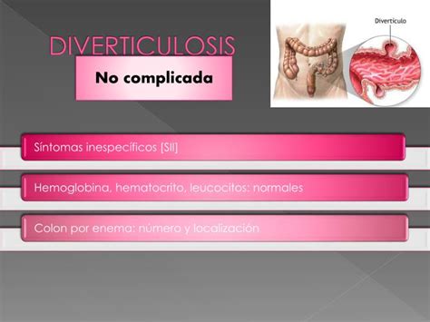 Ppt Enfermedad Diverticular Powerpoint Presentation Id 4011364