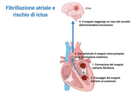 Fibrillazione Atriale Quali Farmaci Per Questa Particolare Patologia