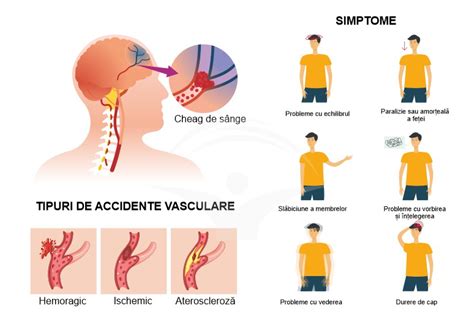 Informatii Utile Despre Accidentul Vascular Cerebral AVC