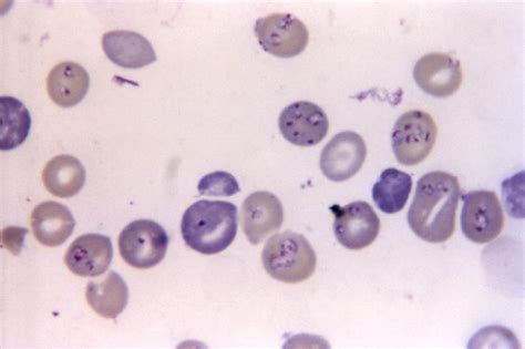 Free picture: babesiosis, confused, malaria, hemo, protozoan, parasites ...