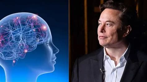 Elon Musk S Neuralink Milestone Wireless Brain Chip Successfully