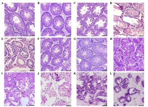 Increased Expression Of Dermatopontin And Its Implications For