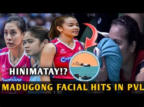 Top Solid Facial Hits In Pvl Literal Na Dumogo Jema Galanza