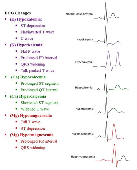 Hyperkalemia ecg changes - barehrom