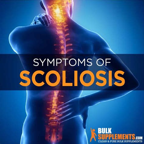 Scoliosis: Symptoms, Causes & Treatment