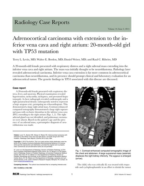 PDF Adrenocortical Carcinoma With Extension To The Inferior Vena Cava