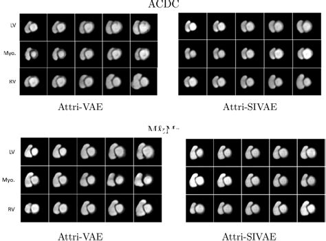 Pdf Attribute Regularized Soft Introspective Vae Towards Cardiac