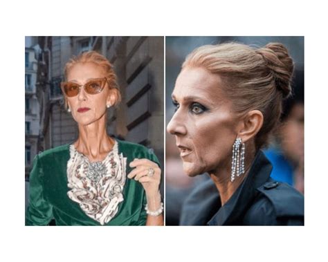 Pretvara se u živu statuu Celine Dion saopštila da boluje od jezive