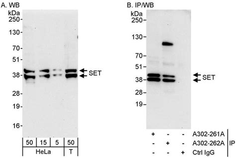 Set Polyclonal Antibody A302 262a