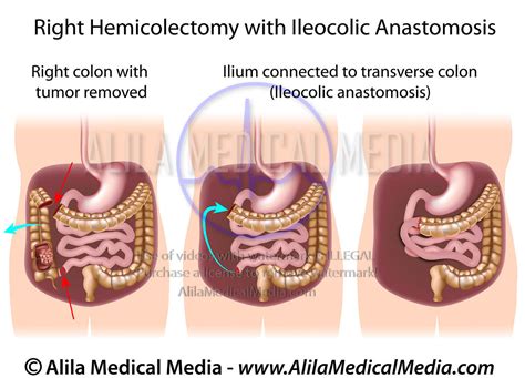 Alila Medical Media Oncology Images Videos