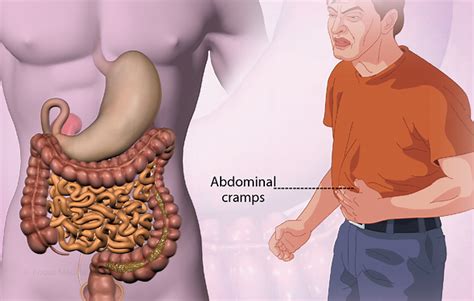 Health Condition : Symptoms, Causes, Treatment and More