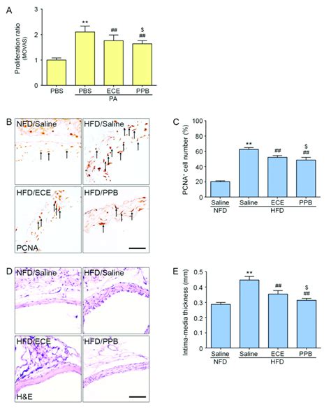 Effects Of Ece And Ppb On Smooth Muscle Cell Proliferation A The