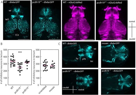 Brain Structural Abnormalities In Pcdh19 Larvae A Representative