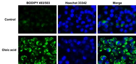 美国APExBIO中文官网 - Green Fluorometric Lipid Droplet Assay Kit (BODIPY 493/503)