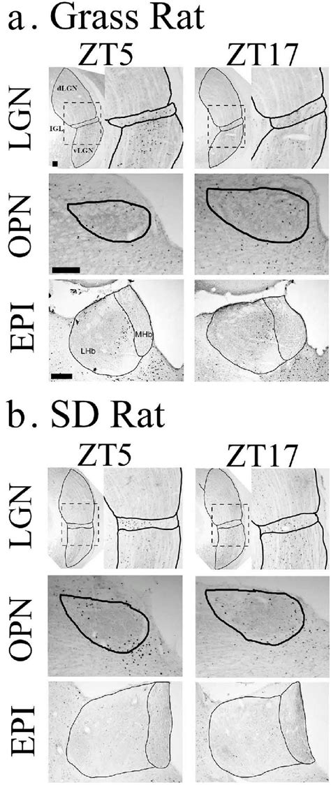 Photomicrographs Of The CFOS Expression At Zeitgeber Time 5 And 17 In