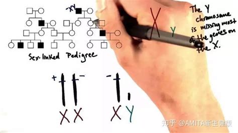 “xxy” Or “xyy”：带你走进真实的“第三性别”群体 知乎