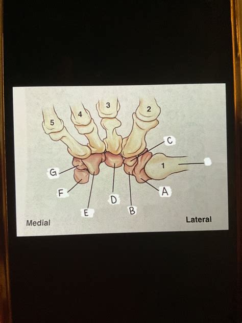 Carpal Tunnel Diagram Quizlet